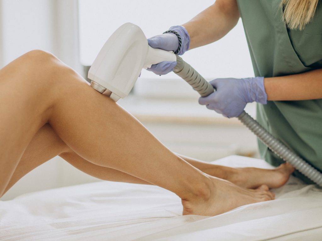 Trattamento epilazione laser